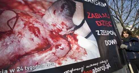 Zabito dziecko, które przeżyło późną aborcję?