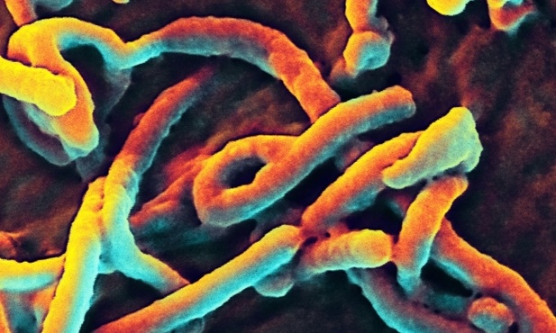 Salezjanie pomagają zarażonym ebolą