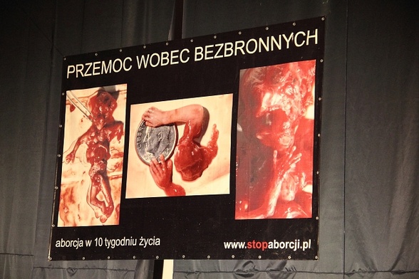 Wystawa pro life "budzi zgorszenie”