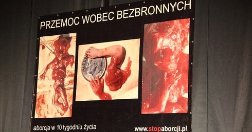 Wystawa pro life "budzi zgorszenie”