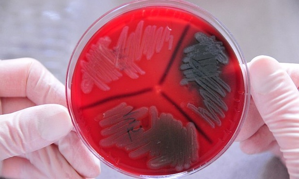Inteligentne bakterie siedzą w… lodówkach