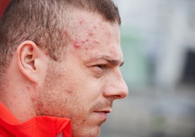 Adrian Zieliński na dopingu