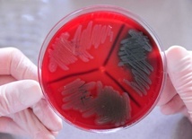 Przydatne bakterie