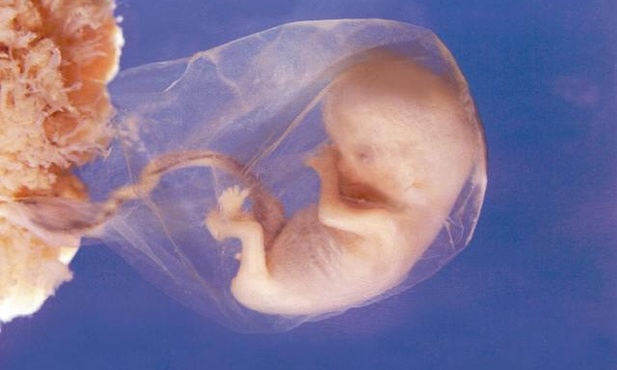 OI: A jednak poparcie dla całkowitego zakazu aborcji znacznie wzrosło
