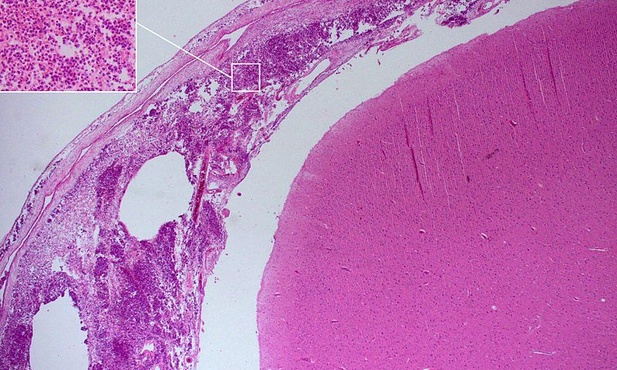 Diagnoza przyjdzie szybciej