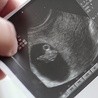 Jak tłumaczą specjaliści, w przypadku tej metody powoływanych jest do życia szereg embrionów, z których część – co wiadomo od samego początku – będzie zabita.
