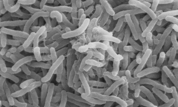 Epidemia: Już 471 ofiar śmiertelnych cholery w Jemenie