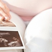 Projekt komitetu #Zatrzymaj Aborcję zakłada zmianę obecnego prawa, likwidując możliwość aborcji w sytuacji, kiedy badania prenatalne wskazują na prawdopodobieństwo wystąpienia nieuleczalnej choroby dziecka.