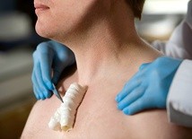 Wydrukowana tchawica może uratować życie człowiekowi.