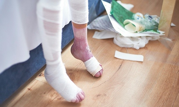 Pęcherzowe oddzielanie się naskórka objawia się powstawaniem na skórze chorego bolesnych, cieknących i pękających bąbli.