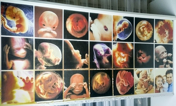 Włochy: 6 milionów aborcji w 40 lat