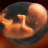 Kolumbia legalizuje aborcję aż do 6 miesiąca ciąży