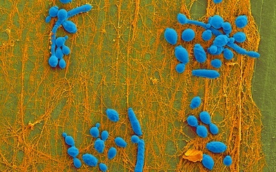 Candida albicans jest stałym lokatorem ciał ok. 70 proc. z nas.