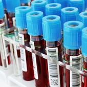 Eksperci: Morfologię krwi powinniśmy wykonywać przynajmniej raz w roku