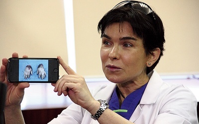 Doc. Anna Chrapusta wyzwań się nie boi. Na zdjęciu podczas konferencji prasowej po replantacji dwóch dłoni odciętych przez gilotynę do cięcia blachy.