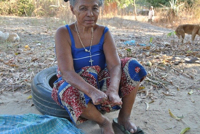 Budowa wiosek dla trędowatych na Madagaskarze