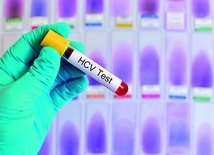 HCV atakuje  po cichu