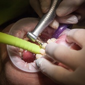 Radlin: stomatolog oszukiwał pacjentów i NFZ