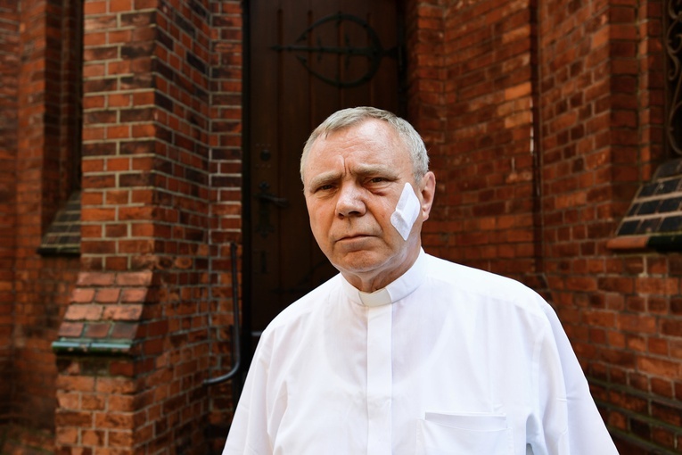 Przewodniczący Episkopatu napisał list do pobitego ks. Aleksandra Ziejewskiego