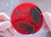 Jak bakterie nas bronią?