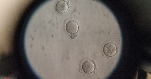 Sprzeciw, ale i propozycja. Komunikat biskupa w sprawie in vitro