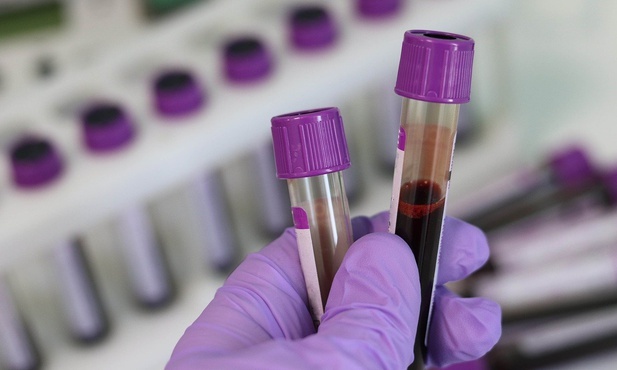 Szumowski o powszechnym stosowaniu testów serologicznych: tak, ale jeszcze na to za wcześnie