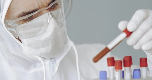 MZ: 159 nowych zakażeń koronawirusem