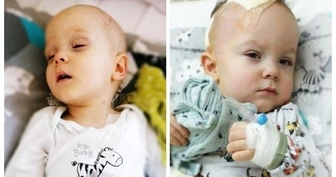 Filip choruje na wyściółczaka anaplastycznego.