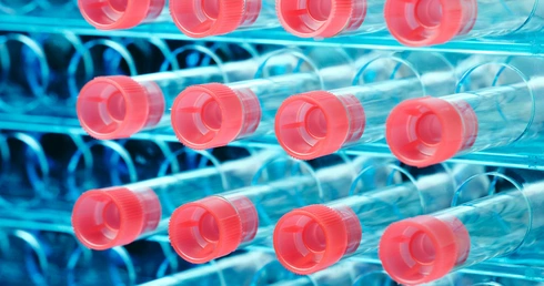 Badania w Krakowie: Liczba chorych bezobjawowych jest większa, niż sądzono