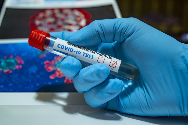 MZ: wyzdrowiało 8 977 pacjentów, u których potwierdzono zakażenie koronawirusem 