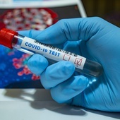 MZ: wyzdrowiało 8 977 pacjentów, u których potwierdzono zakażenie koronawirusem 