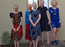 Trwa zbiórka pieniędzy na wyposażenie domu dla osób dotkniętych albinizmem w Tanzanii