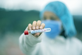 MZ: Najwięcej testów na wykrycie koronawirusa na Mazowszu - blisko 560 tys.