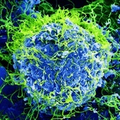 Africa CDC potwierdziła epidemię wirusa Ebola w DRK