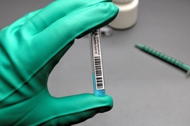Śląskie. Ruszają największe w kraju badania przesiewowe pod kątem mutacji SARS-CoV-2