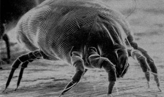 29.04.2021 | Alergia na roztocza a astma