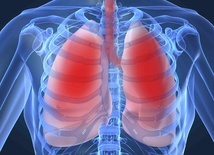 Rok po hospitalizacji z powodu COVID-19 co trzeci pacjent nadal ma zmiany w płucach