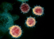 Ultraszybkie i proste testy na koronawirusa