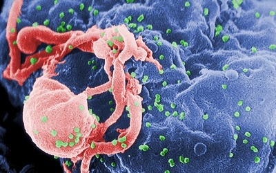 Oxford testuje szczepionkę przeciw HIV