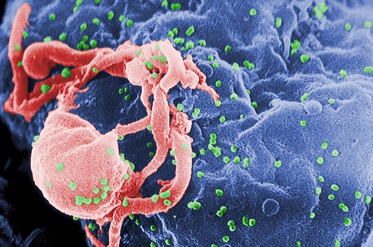 Oxford testuje szczepionkę przeciw HIV