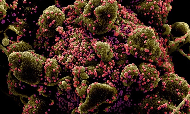 Prof. Kuna: Jestem zwolennikiem zniesienia prawie wszystkich ograniczeń epidemicznych