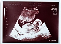 Z narodzeniem Jana Chrzciciela było tak…