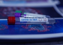 Śląskie. Wzrosła liczba pozytywnych wyników testów na COVID i chorych w szpitalach