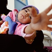 Jemeńskie dziecko cierpiące na niedożywienie otrzymuje wsparcie w szpitalu
13.12.2022  Sana, Jemen