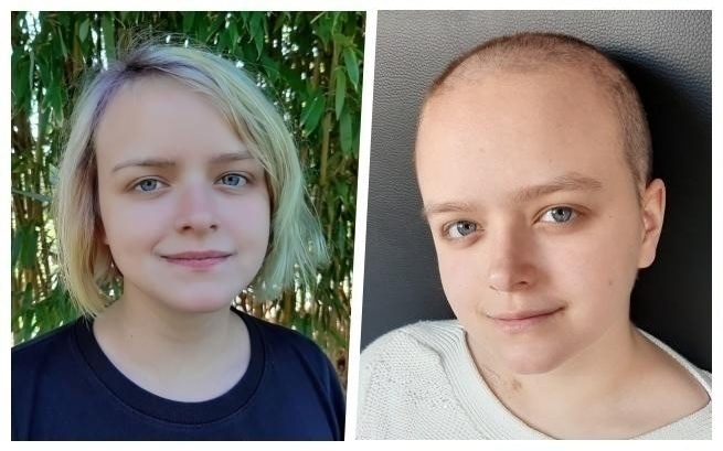 20-letnia Karolina walczy o nadzieję na życie