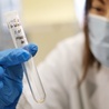 Wirusolog o pandemii: Nie jest tak dobrze, jakby się nam wydawało