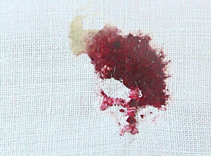 Wydarzenie eucharystyczne z Legnicy przypomina scenariusz z Sokółki. Ciało Pańskie, które spadło na ziemię podczas udzielania Komunii Świętej, zostało umieszczone w naczyniu z wodą i wstawione do tabernakulum. Po kilku dniach okazało się, że Hostia nie uległa rozpuszczeniu, a na jej powierzchni pojawiło się czerwone przebarwienie. Badanie naukowe dowiodło, że jest to fragment ludzkiego serca. Na zdjęciu: przemieniona w mięsień sercowy Hostia z Sokółki.