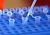 Pierwsza terapia genowa oparta na systemie CRISPR zatwierdzona w USA