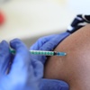 Pierwsza na świecie personalizowana szczepionka mRNA przeciwko rakowi skóry