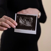 W tym szaleństwie jest aborcja